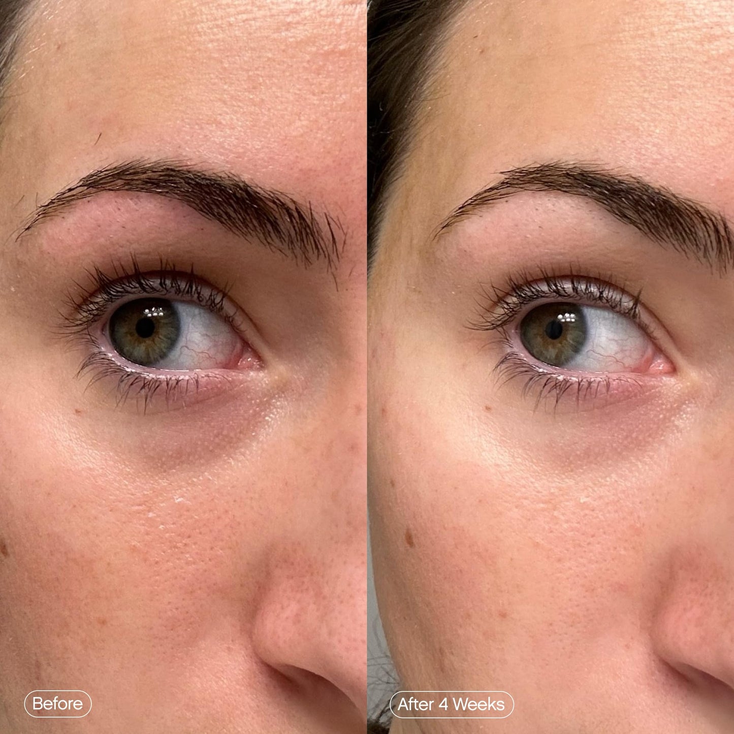 TOPICALS FADED Under Eye Patches